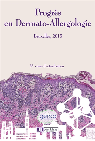 Progrès en dermato-allergologie : Bruxelles 2015