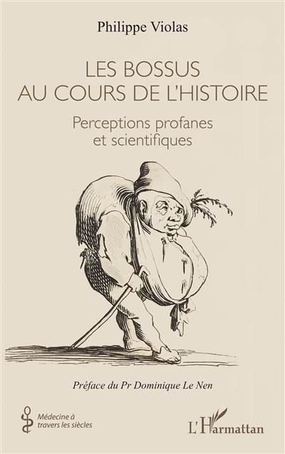Les bossus au cours de l'histoire : perceptions profanes et scientifiques