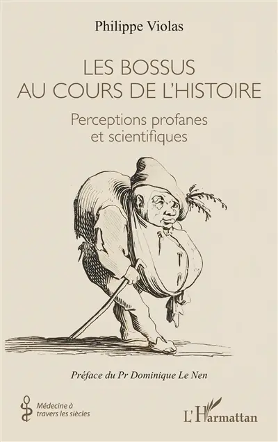 Les bossus au cours de l'histoire : perceptions profanes et scientifiques