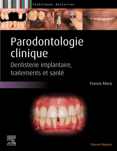 Parodontologie clinique : dentisterie implantaire, traitements et santé