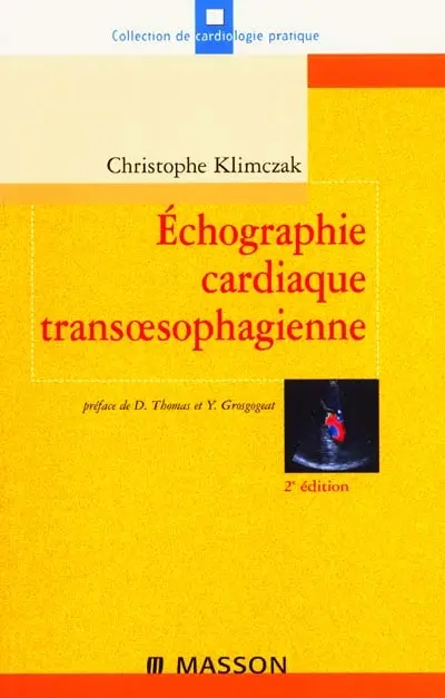 Échographie cardiaque transoesophagienne