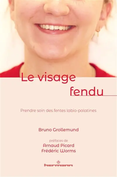 Le visage fendu : prendre soin des fentes labio-palatines