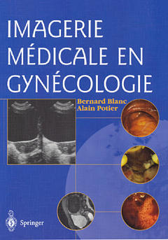 Imagerie médicale en gynécologie