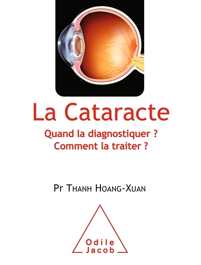 La cataracte : quand la diagnostiquer ? comment la traiter ?