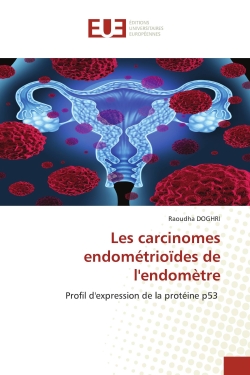 Les carcinomes...
