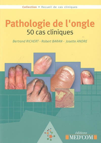 Pathologie de l'ongle : 50 cas cliniques
