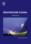 Mésothéliome pleural
