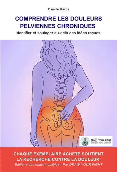 Comprendre les douleurs pelviennes chroniques