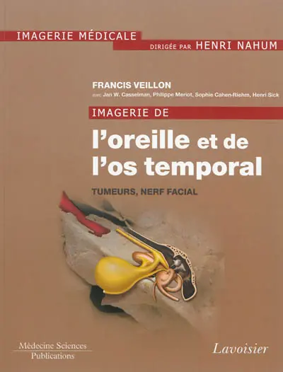 Imagerie de l'oreille et de l'os temporal. Vol. 4. Tumeurs, nerf facial