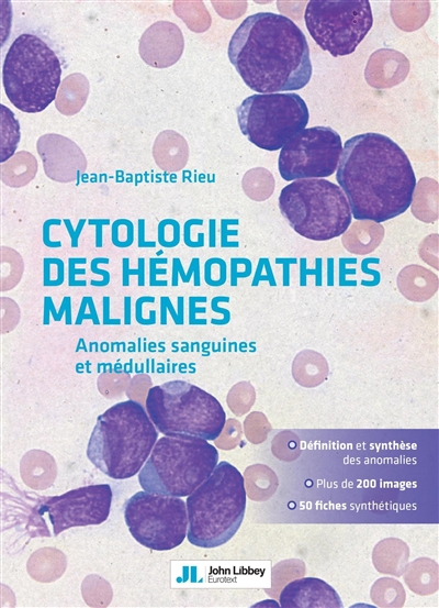 Cytologie des hémopathies malignes : anomalies sanguines et médullaires