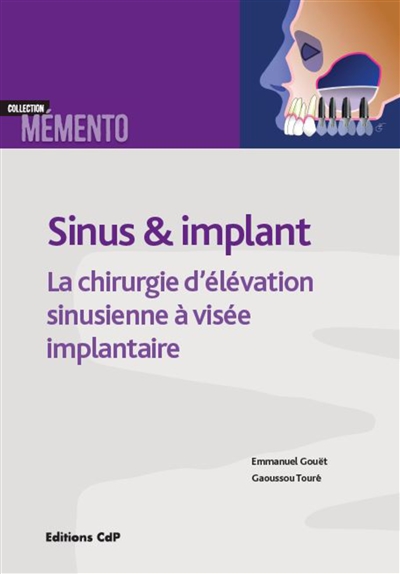 Sinus & implant : la chirurgie d'élévation sinusienne à visée implantaire