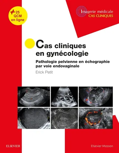Cas cliniques en gynécologie : pathologie pelvienne en échographie par voie endovaginale