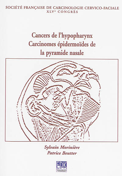 Cancers de l'hypopharynx, carcinomes épidermoïdes de la pyramide nasale