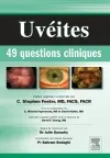 Uvéites : 49 questions cliniques