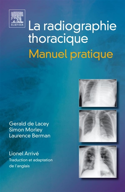 La radiographie thoracique : manuel pratique
