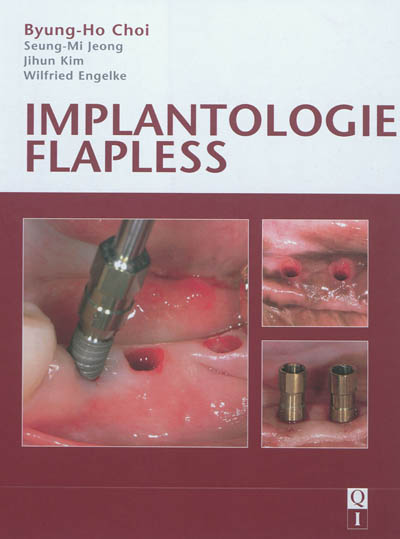 Implantologie flapless
