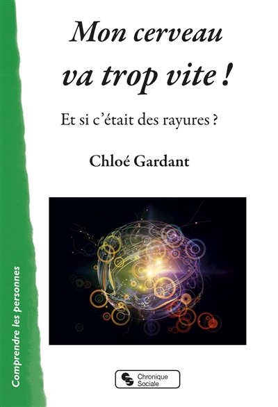 Mon cerveau va trop vite ! : et si c'était des rayures ?