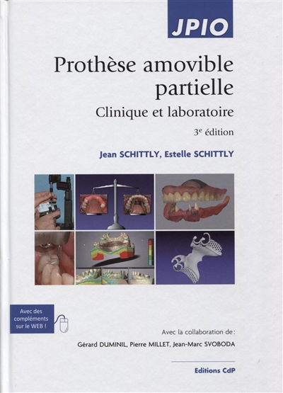 Prothèse amovible partielle : clinique et laboratoire