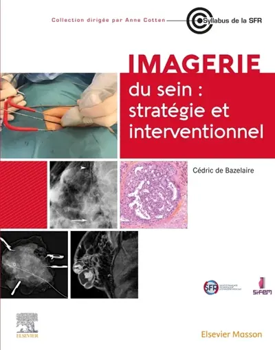 Imagerie du sein : stratégie et interventionnel Imagerie du sein : stratégie et interventionnel