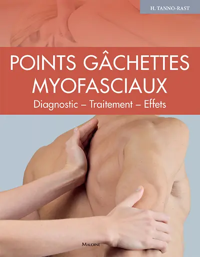 Points gâchettes myofasciaux : diagnostic, traitement, effets