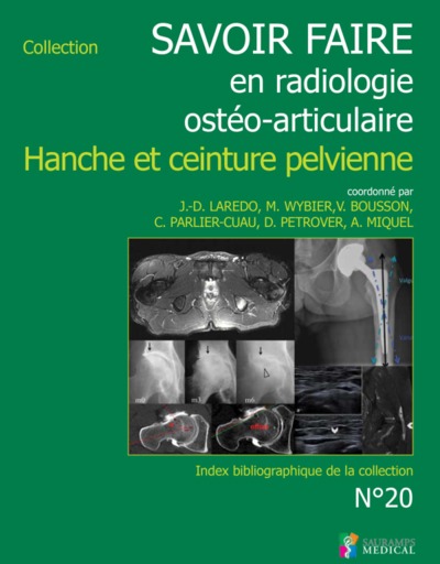 Savoir faire en radiologie ostéo-articulaire. Vol. 20. Hanche et ceinture pelvienne
