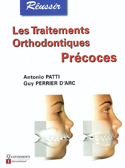 Les traitements orthodontiques précoces