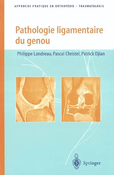 Pathologie ligamentaire du genou