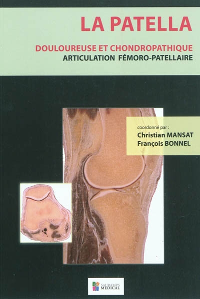 La patella : douloureuse et chondropathique, articulation fémoro-patellaire : anatomie, biomécanique, clinique, rééducation, chirurgie