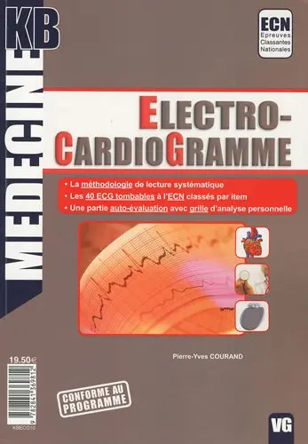 Electro-cardiogramme