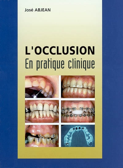 L'occlusion : en pratique clinique