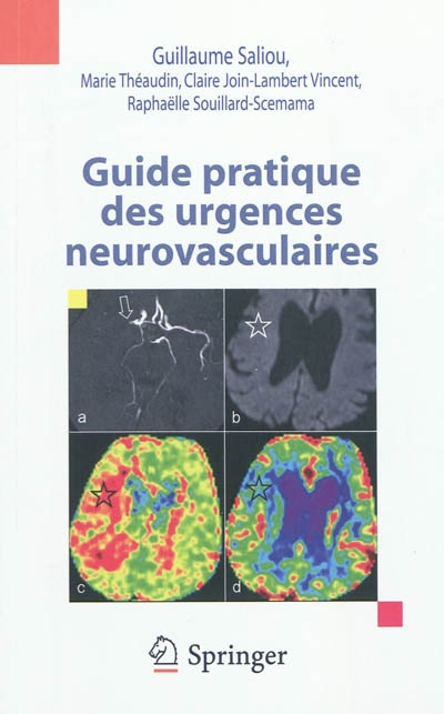 Guide pratique des urgences neurovasculaires