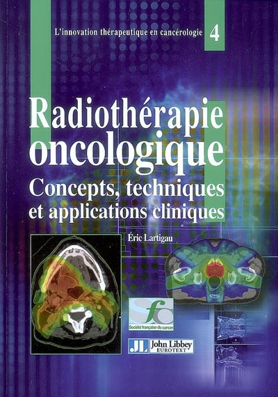 Radiothérapie oncologique : concepts, techniques et applications cliniques