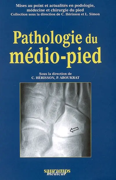 Pathologie du médio-pied