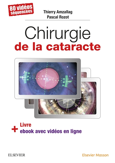 Chirurgie de la cataracte : 80 vidéos séquencées : livre + ebook avec vidéos en ligne