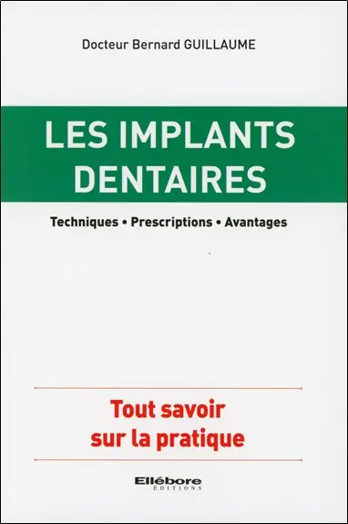 Les implants dentaires : techniques, prescriptions, avantages : tout savoir sur la pratique