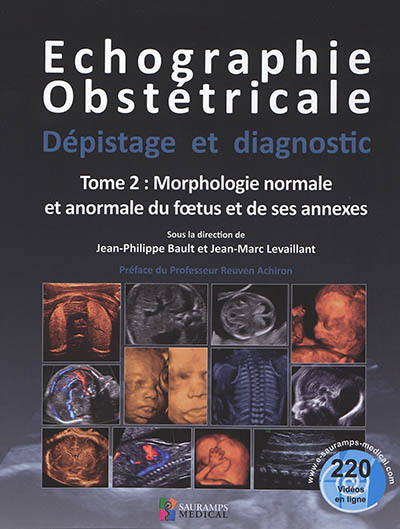 Echographie obstétricale : dépistage et diagnostic. Vol. 2. Morphologie normale et anormale du foetus et de ses annexes