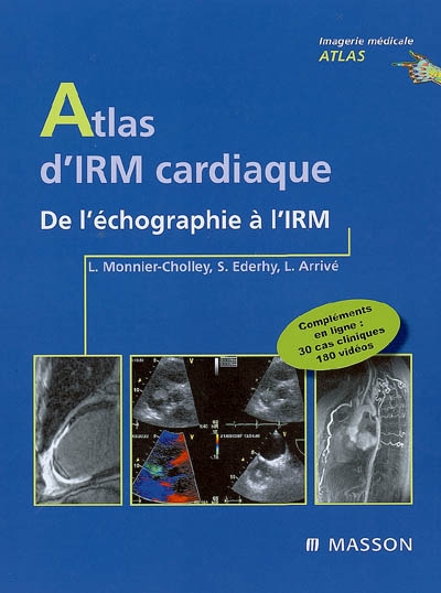 Atlas d'IRM cardiaque : de l'échographie à l'IRM