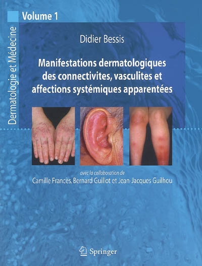 Dermatologie et médecine. Vol. 1. Manifestations dermatologiques des connectivites, vasculites et affections systémiques apparentées