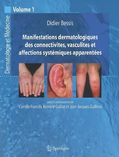 Dermatologie et médecine. Vol. 1. Manifestations dermatologiques des connectivites, vasculites et affections systémiques apparentées