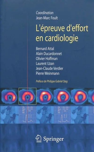 L'épreuve d'effort en cardiologie
