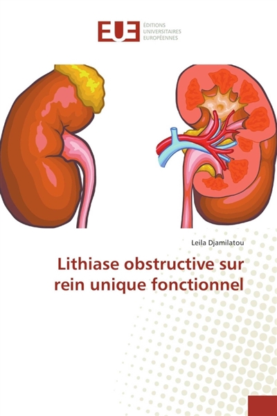 Lithiase obstructive sur...