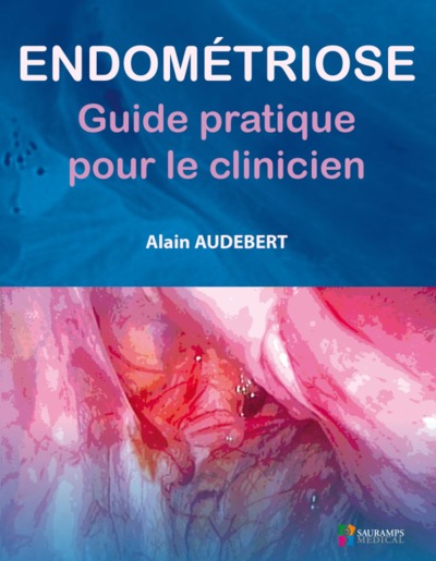 Endométriose : guide pratique pour le clinicien