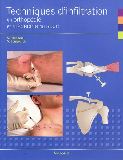 Techniques d'infiltration en orthopédie et médecine du sport : un manuel pratique pour les médecins