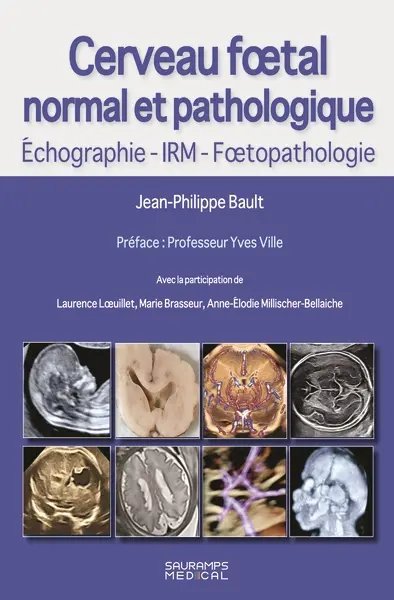 Cerveau foetal normal et pathologique : échographie, IRM, foetopathologie