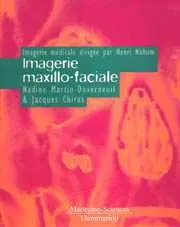 Imagerie maxilo-faciale