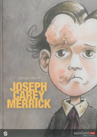 Joseph Carey Merrick