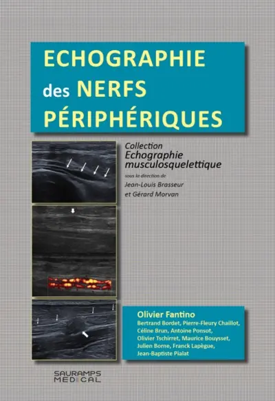 Echographie des nerfs périphériques