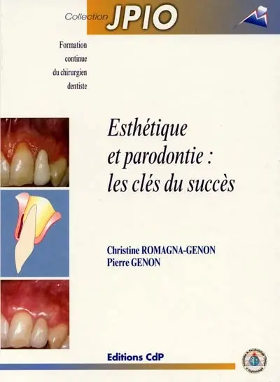 Esthétique et parodontie : les clés du succès