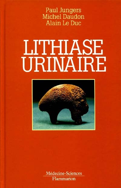 Lithiase urinaire