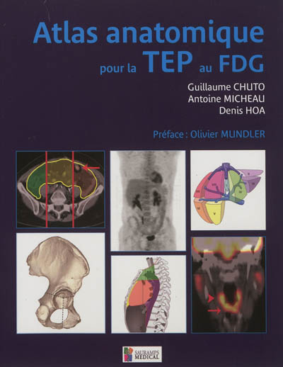 Atlas anatomique pour la TEP au FDG